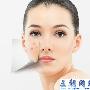 熬夜脸上长痘痘怎么办