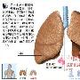 人体11个最易患癌部位最新排名 生活_美丽顾问