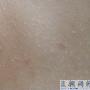 请问大家这是什么病呀？