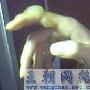 手指被汤烫伤了.起了好大的泡泡怎么处理不会留巴?