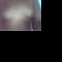 为什么我一个男孩乳房比女生还大
