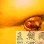 痔疮肛门肥大突出怎么办?(附图)