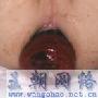 求医`肛门处不知道是什么