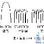 G.992.2 Modem 及其组网应用方案