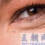 利用Photoshop修补工具去除眼袋