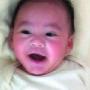 李嘉欣分享儿子笑脸照片 孕期三动手术除肾结石