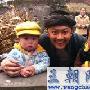 印小天自曝受伤肌腱断裂 手指变形痛苦复健(图)