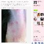 李阳妻子再发家暴照 称不会等李阳负责任(图)