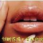 春天口唇起燎泡怎么办-亲亲我健康