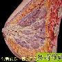 乳腺增生≠乳房有肿块