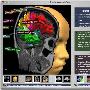 《可视化核磁共振图像数据分析软件》(BrainVoyager QX )v2.0.7 WIN32[压缩包]