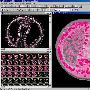 《医用三维图形建模系统》(3D-Doctor)v4.0.20100325/WinAll/含破解补丁[压缩包]