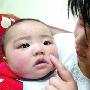 婴儿脸上长水泡 强生润肤露被疑致婴儿过敏(图)