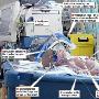 英国婴儿冷冻4天成功实施心脏手术(图)
