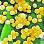 “超级细菌”蔓延至美加 全球感染者达数百人