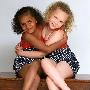 英双胞胎姐妹肤色各异 未来或现奇特混血人种