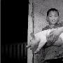 湖南现六条腿两肛门小猪 专家称因胚胎变异