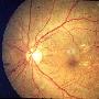 專家用人類胚胎幹細胞培育出立體視網膜組織