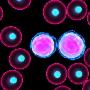 白血病治疗新突破 细胞疗法可杀死癌变细胞