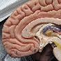 科學家實現用大腦植入物進行無線控制電腦