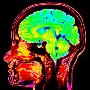 婴儿时期大脑细胞快速发育导致童年回忆缺失