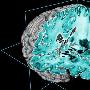 科学家获得迄今最清晰的人体大脑3D图像