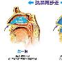 治疗鼻炎的好方法——盐水洗鼻