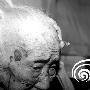 海南儋州103岁阿婆头上长出一只软软肉“角”(图)