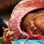 全世界轰动！印度夫妇生下双面女婴(图)