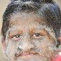 印度男孩患先天性多毛症 全身长毛(组图)