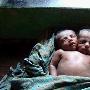 轰动全球！孟加拉国惊现双头婴儿 仅存活2天