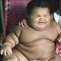 体重暴增如吹气球 11个月大男婴体重与8岁儿童相当[组图]