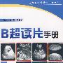 B超读片手册
