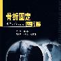 骨折固定图谱