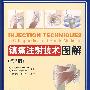 镇痛注射技术图解(第3版)