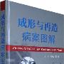 成形与再造病案图解