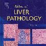 肝脏病理学图谱Atlas of Liver Pathology