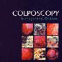 阴道镜：治疗选择 Colposcopy