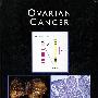 子宫癌Ovarian Cancer