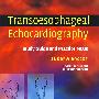 Transoesophageal Echocardiography经食管超声心动图检查术