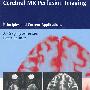 颅脑MR灌注影像 Cerebral MR Perfusion Imaging