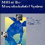 骨骼肌肉系统MRIMRI of the Musculoskeletal System