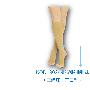 土耳其VARITEKS KOD-902小腿静脉曲张袜（开口型）